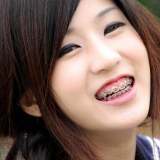 น้องนักเรียนใส่เหล็กดัดฟันน่าร๊ากก